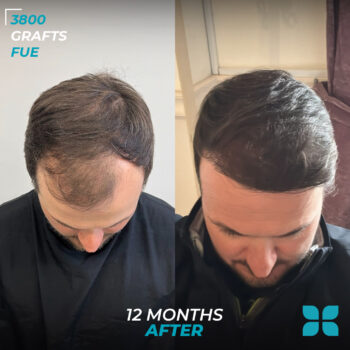 Before After